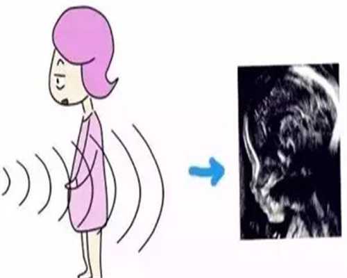 东莞代生宝宝-广州代生产的概念