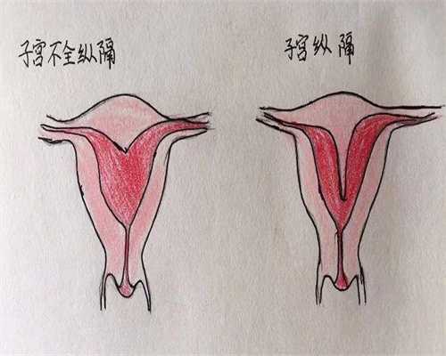 试管移植前检查正常还会失败吗