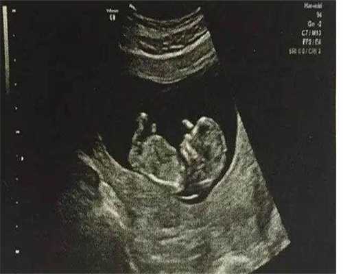 广州代怀孕价格60万，广州三代试管包生男孩价格是多少？10万够吗？