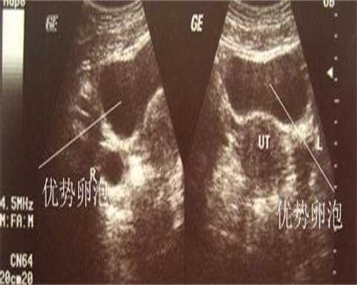 广州借卵子试管的人多吗，广州供卵代生男孩（广州借卵自怀）