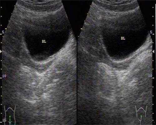 急找广州代生，广州做试管婴儿