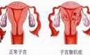 广州代生孩子价格是多少，广州三代试管包生男孩价格